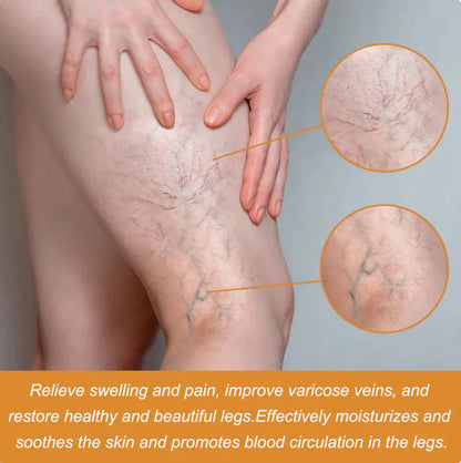 Turmeric Varicose Vein Relief Spray Buy 1 Get 1 Free